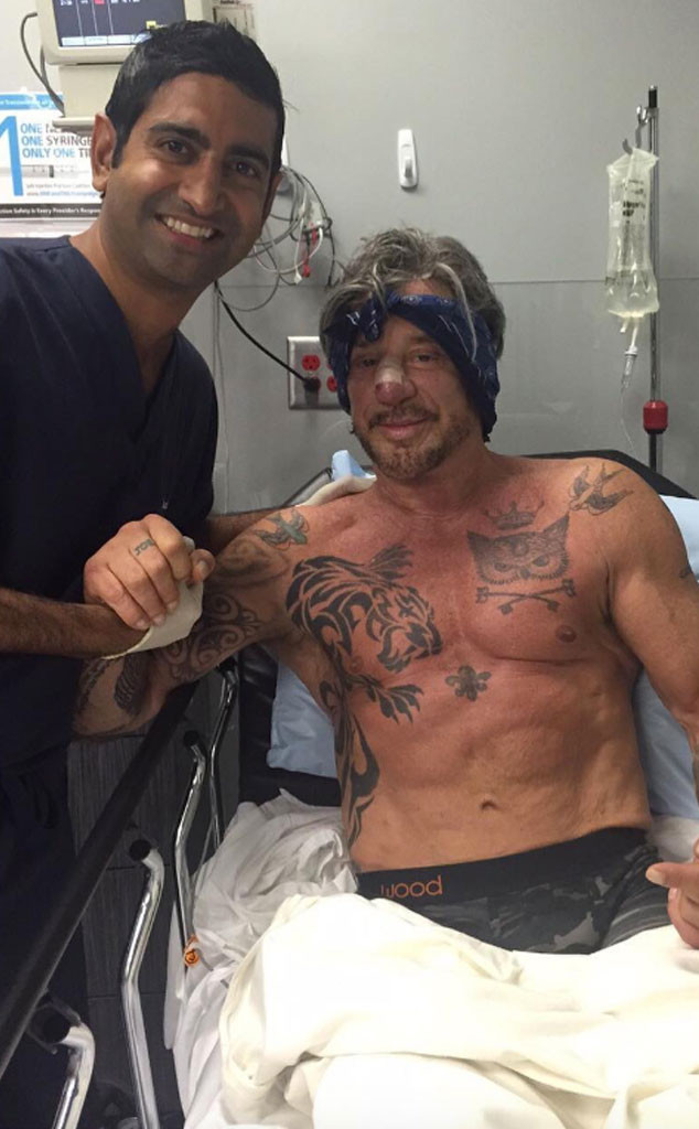 Mickey Rourke Gets a Nose Job: Now I Am Pretty Again | E! News